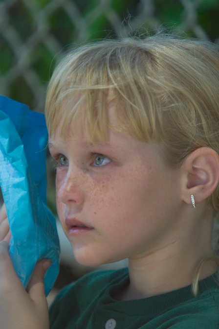 Annie holds an icepack to her eye